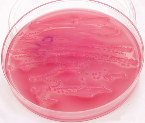 Καλλιέργεια Escherichia coli σε MacConkey άγαρ