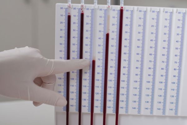 Μέτρηση ταχύτητας καθίζησης ερυθρών