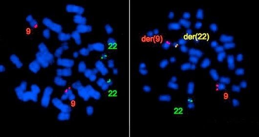 Metaphase