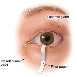 Schirmer Test