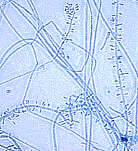 Trichophyton rubrum